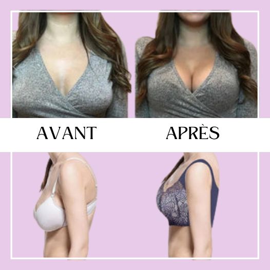 Comflit™ | Soutien-Gorge Push-Up Confortable